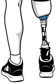 Prosthetic Limbs