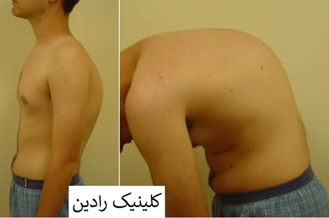 انواع قوز