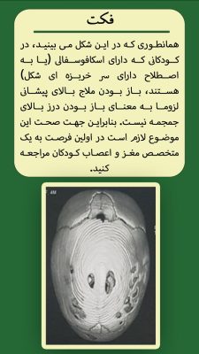 سر خربزه ای