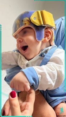 کلاه فرم دهی سر نوزاد