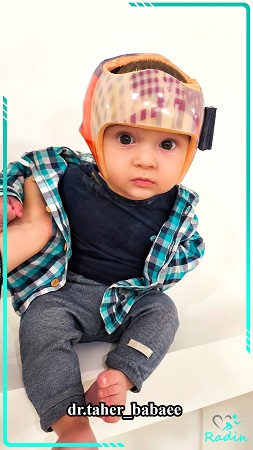 کودکی که کلاه فرم دهی بر سر دارد یک