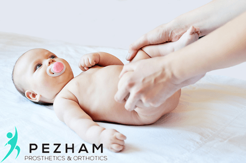 درمان دررفتگی مادرزادی لگن