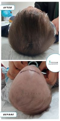 کلاه فرم دهی سر نوزاد