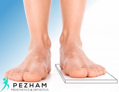 کوتاهی واقعی و کاذب پا