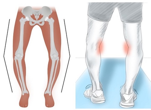 پای پرانتزی