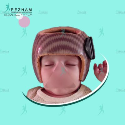 کلاه فرم دهی سر نوزاد در هنگام خواب 