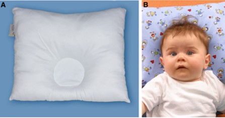 بالش فرم دهی سر نوزاد