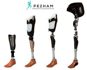 انواع پروتز های پا.قیمت پروتز پا.پای مصنوعی