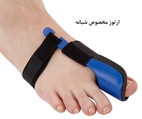 ارتوز شبانه شصت پا