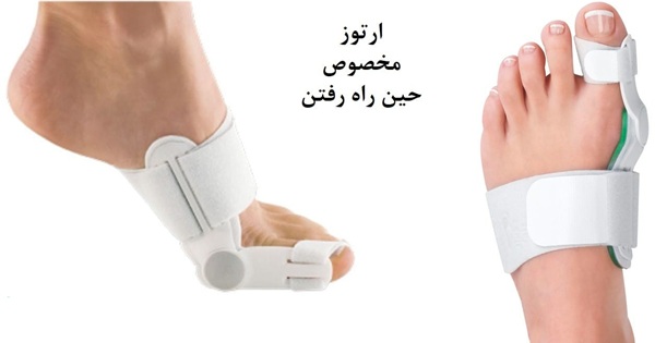 ارتوز مخصوص حین راه رفتن برای انحراف شست پا