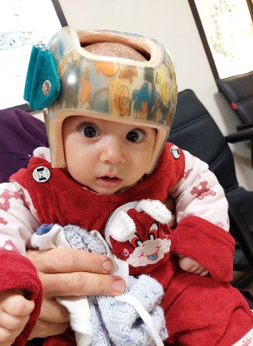 خرید اینترنتی کلاه فرم دهی سر نوزاد