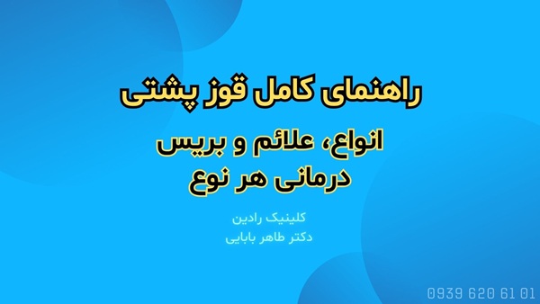 راهنمای کامل کایفوز یا قوز پشتی