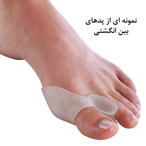 نمونه پد بین انگشت برای انحراف شست پا