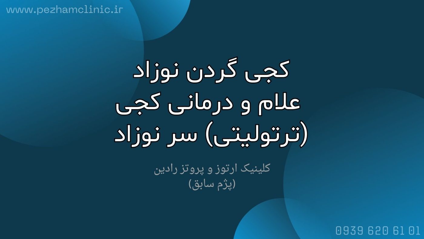 کجی گردن نوزاد