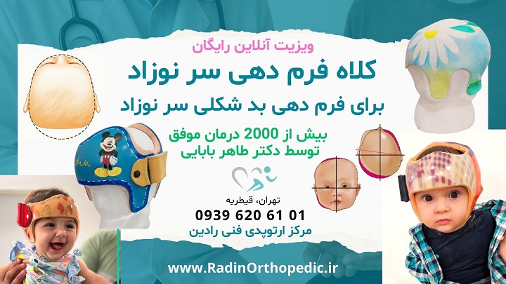 کلاه فرم دهی سر نوزاد برای درمان انواع بدفرمی سر جمجمه نوزاد